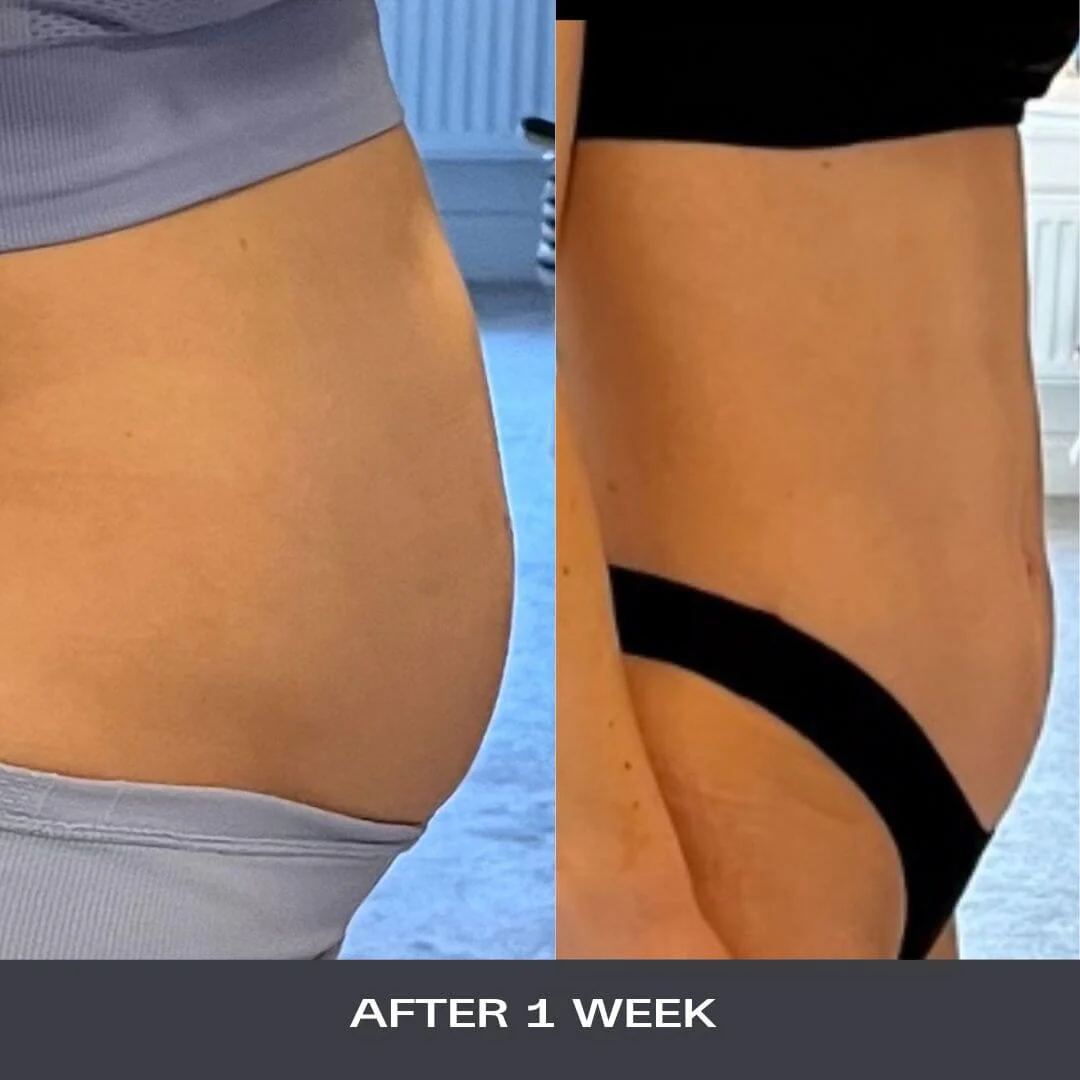 A Dose For Bloating - Image 4